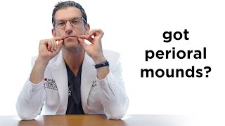 Do you have Perioral Mounds? This Newport Beach Plastic Surgeon may have the solution for you