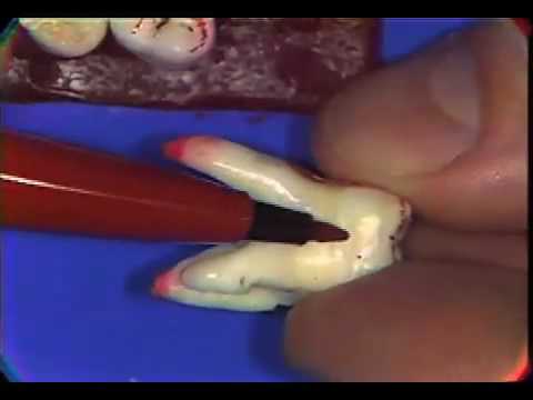 Maxillary Premolars Review II