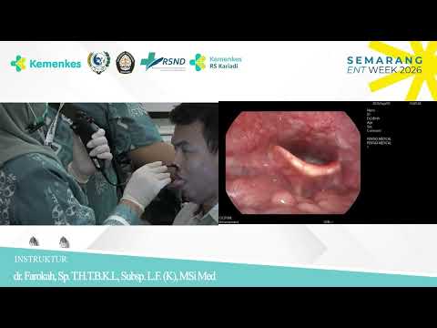 FOL (Flexible Optic Laryngoscopy)