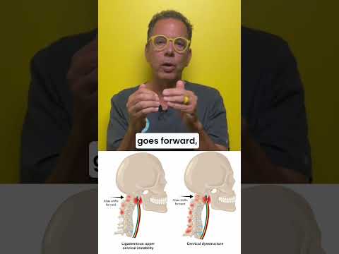 Long haul covid and vagus nerve degeneration #longcovid #vagus #cervicalinstability