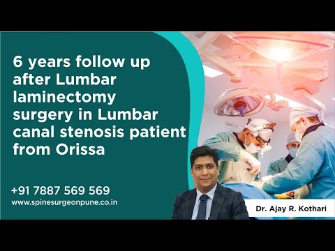 Patient Testimonials | Dr. Ajay Kothari - Spine Surgeon | Shivaji Nagar, Pune