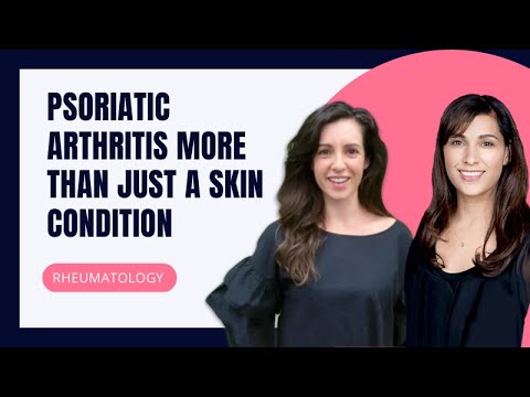 YouTube video about The majority of people with psoriasis won’t develop psoriatic arthritis.