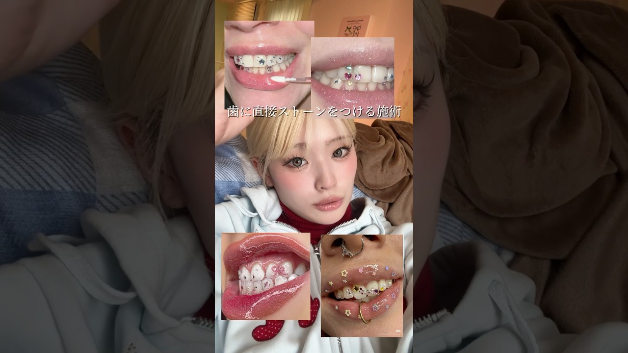 つけ外しできるティースジュエリー🦷💎見つけた‼️歯のアクセサリーって素敵。わくわっくーする！のでみんなにシェアハピ🪽