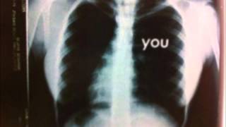 Diamond Rings -  Runaway Love (Stars Remix)