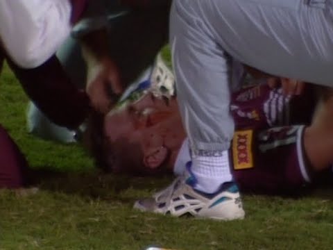 Ian Roberts Breaks Jason Smith's Jaw - Origin 1994