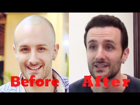 download lagu mp3 mp4 David Austin Hair, download lagu David Austin Hair gratis, unduh video klip David Austin Hair