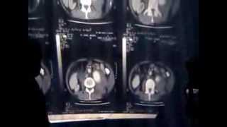 Surgical Radiology - 6 - miscellenious scintiscans & CTs