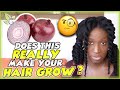 The Onion Juice Hair Growth Secret Scientific Facts And Benefits