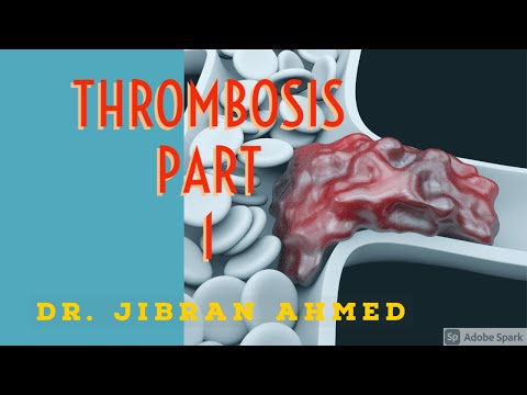 GENERAL PATHOLOGY II EDEMA EFFUSIONS HYPEREMIA CONGESTION II CHAP 4 II ROBBINS 10TH EDITION