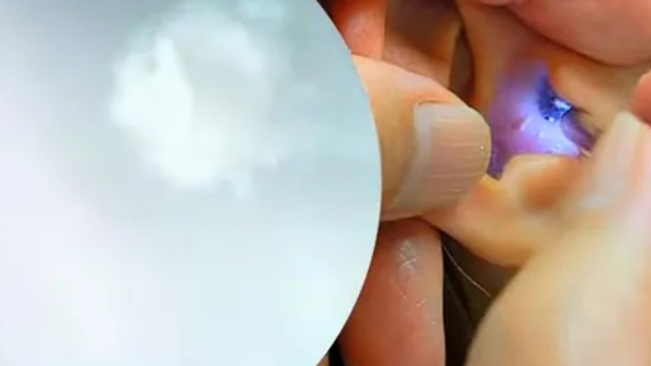 2025.7【床屋の耳掃除】おばあちゃん 女性モデル イヤースコープ使ってみてもらってみた(右耳)