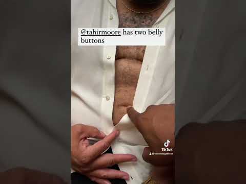 Tahir Moore has two belly buttons