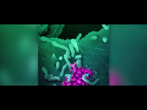 Researchers find COVID-19 can infect multiple organs