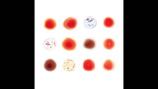 Arcade Fire - Games Without Frontiers