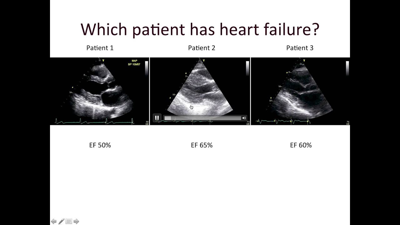 Maan Jokhadar: Diastolic Dysfunction and Diastolic Heart Failure