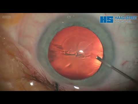 Haag-Streit Surgical ALLEGRA 900