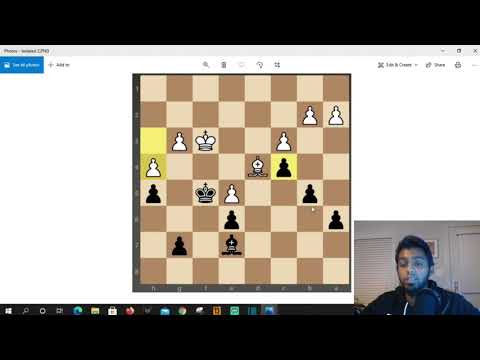 5 Pawn Weaknesses Every Chess Player Should Know