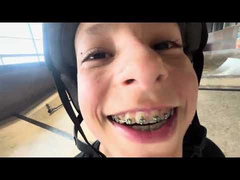 🔥 NKD GOAT Trick Scooter – Featuring Hugo D PRO Rider | Skatepark Action in France 🇫🇷