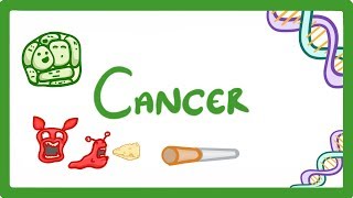 GCSE Biology - What is Cancer? 'Benign' and 'Malignant' Tumours Explained  #43