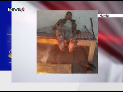 कोरोना भाइरसको संक्रमण भएको आशंका - NEWS24 TV