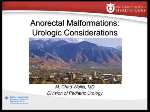 5.21.2020 PedsUroFLO Lecture - Anorectal Malformations: Urologic Considerations