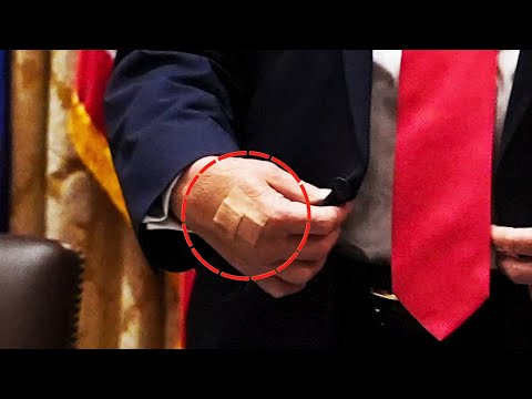 TRUMP HEALTH PANIC: NOW IT’S BANDAGES