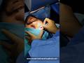 Tired Of Using Glasses Let It Go Eyehospitals Lasik Lasiksurgeon Eyecare Hyderabad Prk
