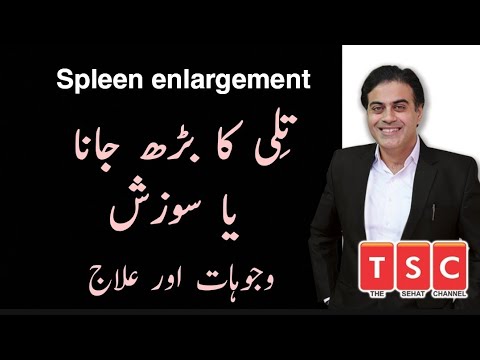 Spleen Enlargement Causes Symptoms and Treatment| Tili ka barh jana By Adeel mansoor