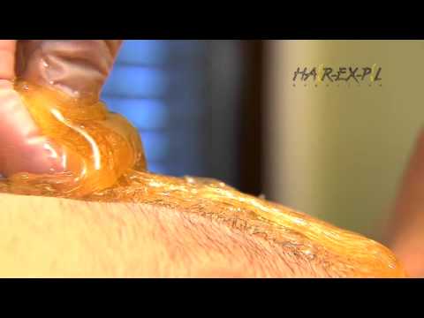 sugaring - the gentle hair removal method with hairexpil sugarpaste