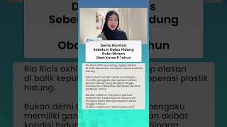 Alami Hidung Bengkok, Ria Ricis Ngaku Rutin Minum Obat Pernapasan selama 5 Tahun sebelum Operasi