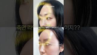 자연스럽게 이뻐지는 피부 시술 3가지🫶