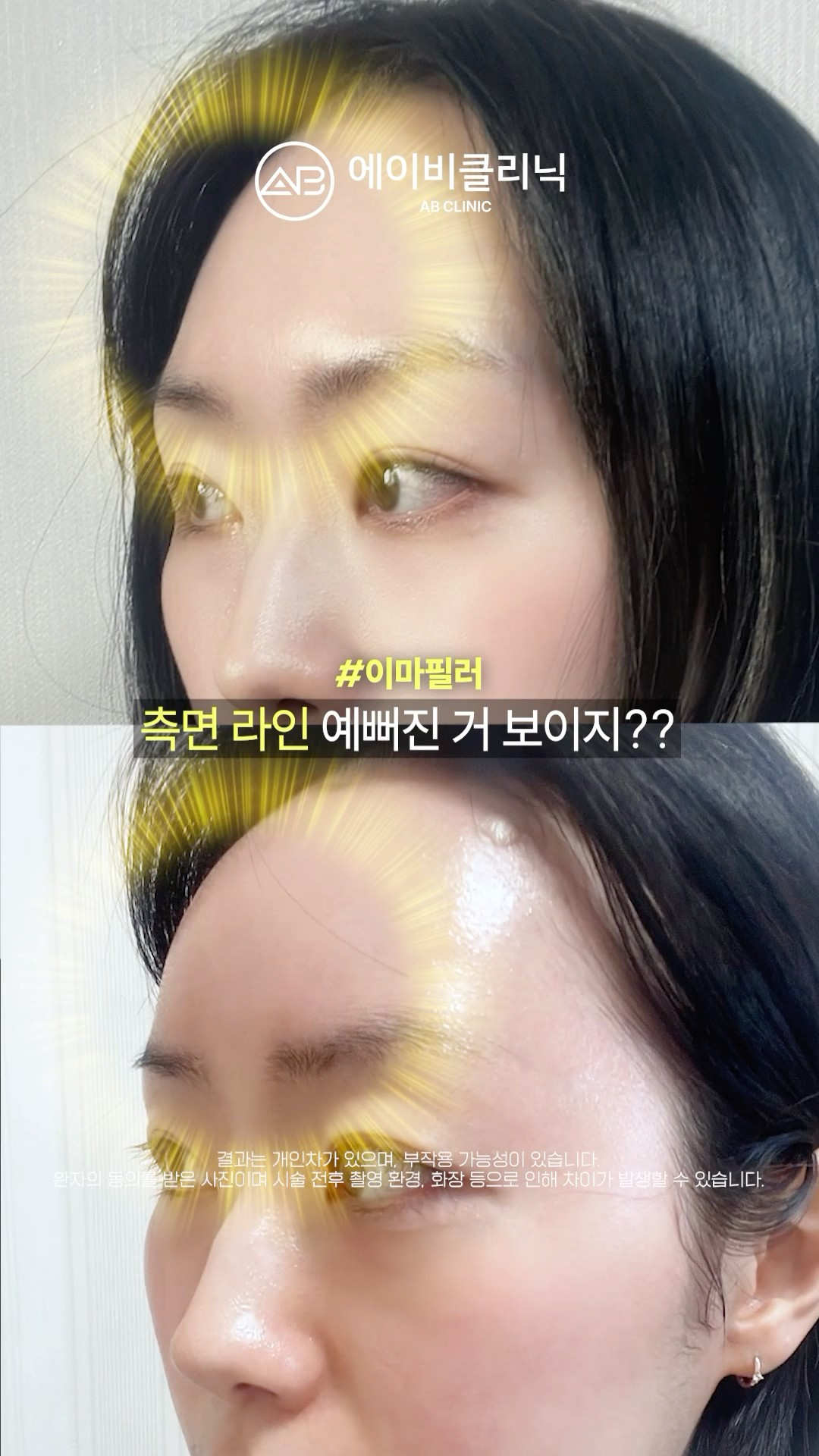 자연스럽게 이뻐지는 피부 시술 3가지🫶