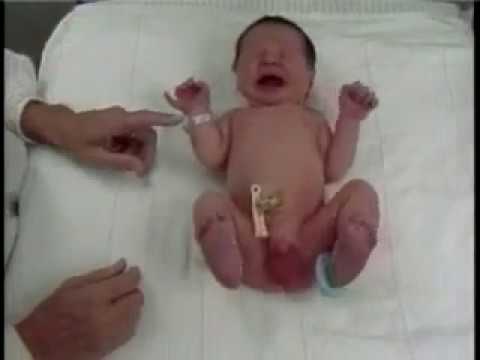 New Ballard Score Chapter 1