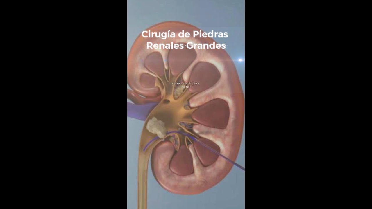 Jorge Alberto Juárez Varela-99