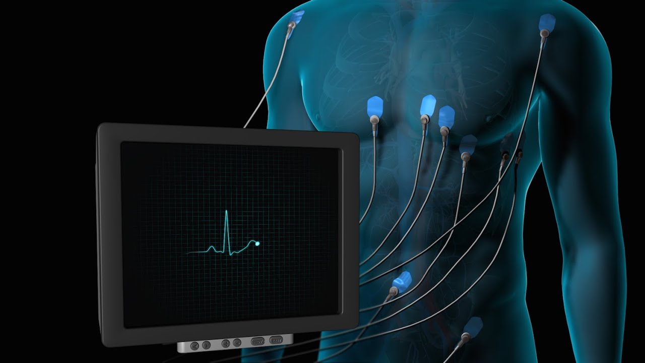 Abdón Ávila Chávez-52