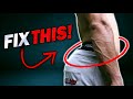 How to Fix Anterior Pelvic Tilt (5 Stretching Exercises)