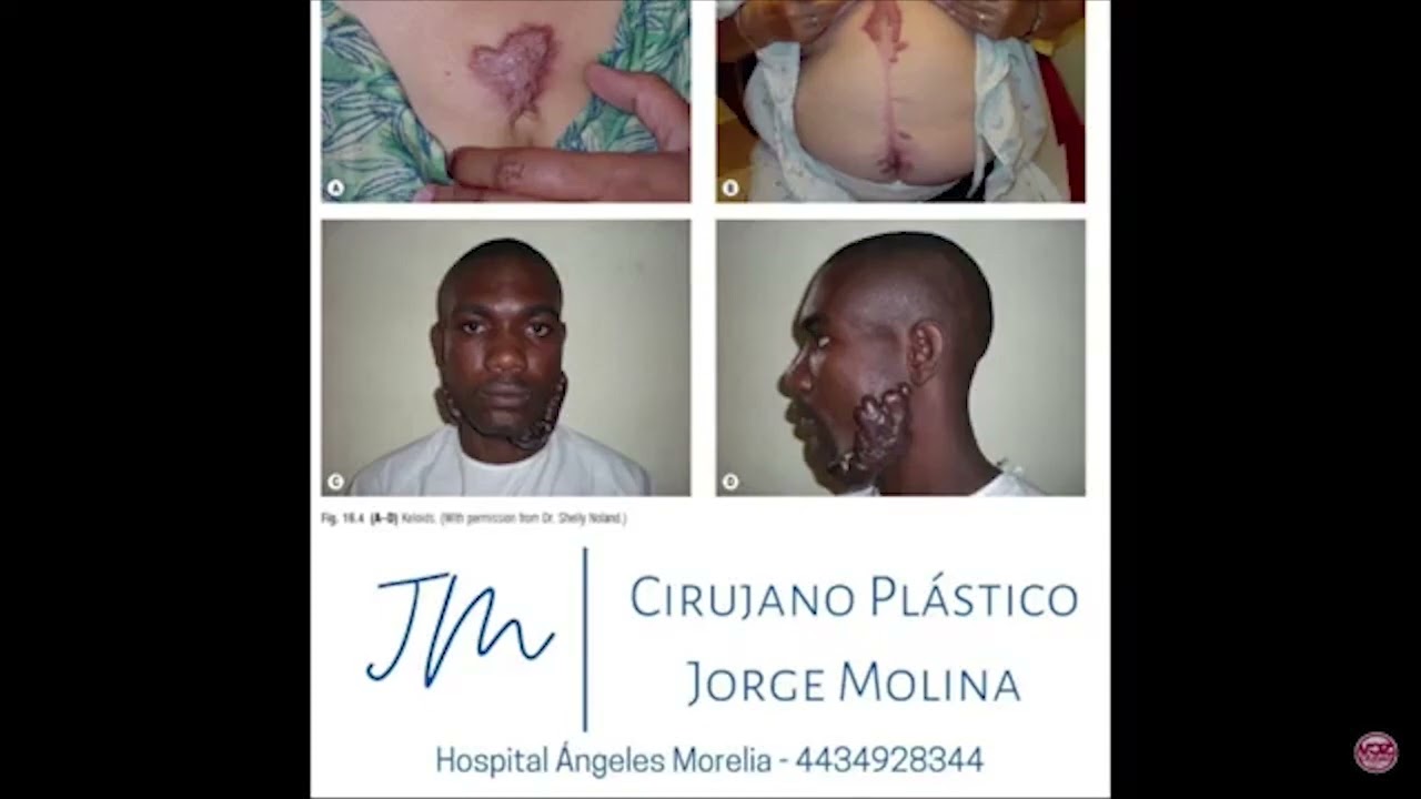 Jorge Eduardo Molina Ortega-18