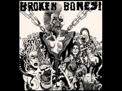 Broken Bones-Terrorist Attack