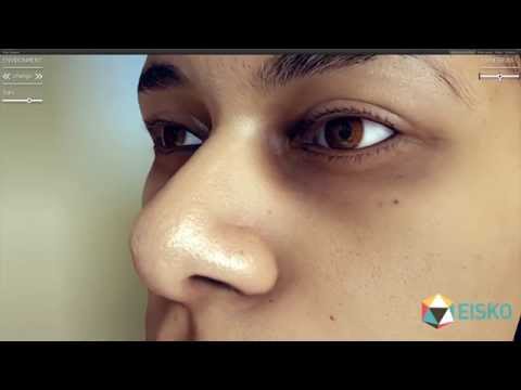 Real-time normal blending and SSS skin bleeding in Unity 3D (2014)