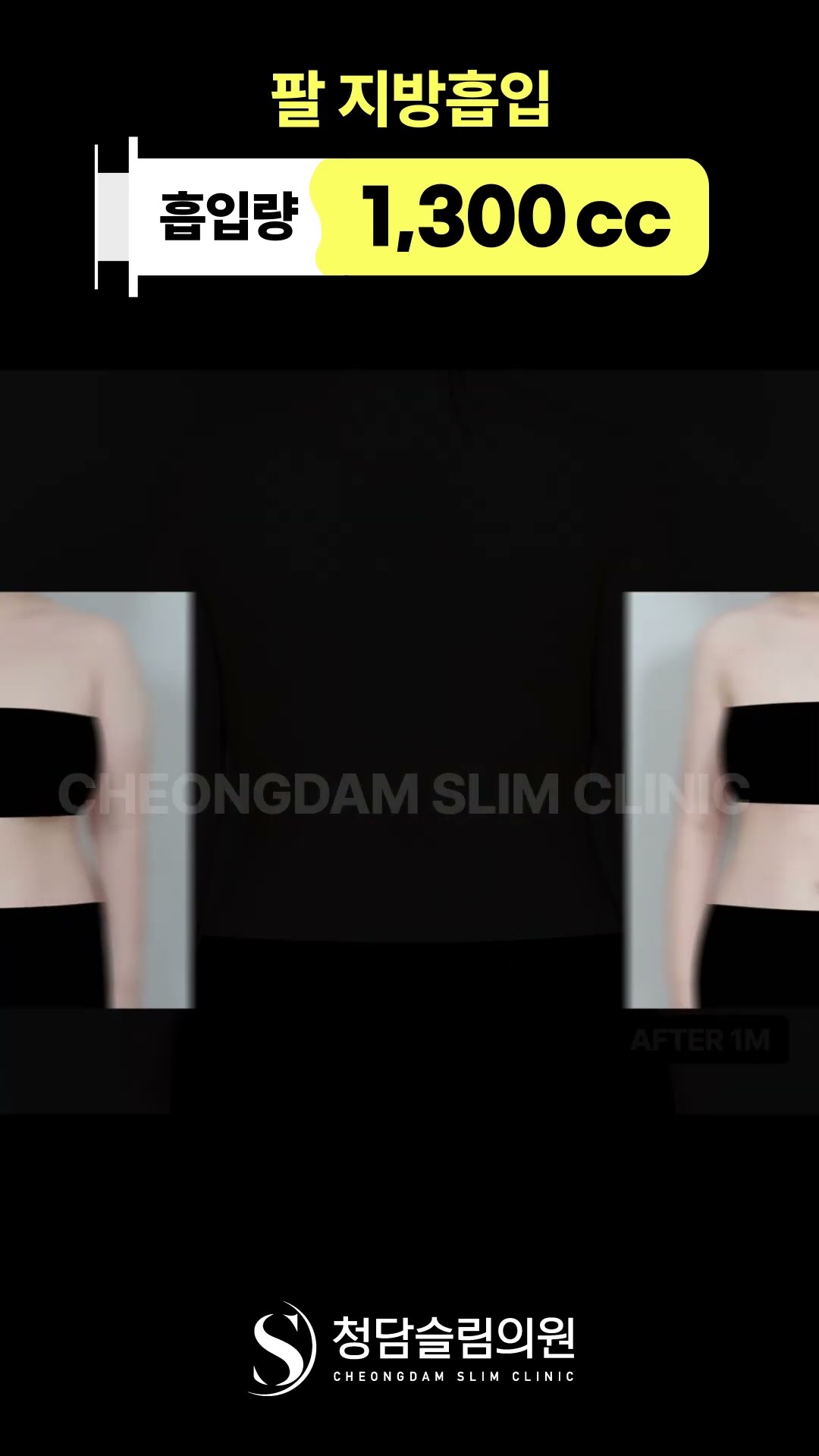 팔부터 등까지 실루엣 정리됨 💪✨