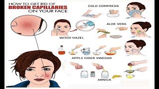 How to Get Rid of Broken Capillaries on Your Face