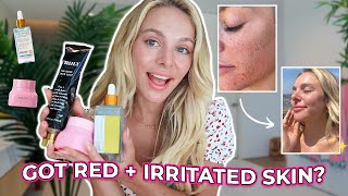 How I Cleared My Red Irritated Skin Truly Beauty!
