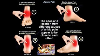 Ankle Pain - Everything You Need To Know - Dr. Nabil Ebraheim