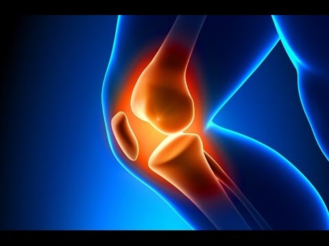 download lagu mp3 mp4 Knee Replacement Surgery In India, download lagu Knee Replacement Surgery In India gratis, unduh video klip Knee Replacement Surgery In India