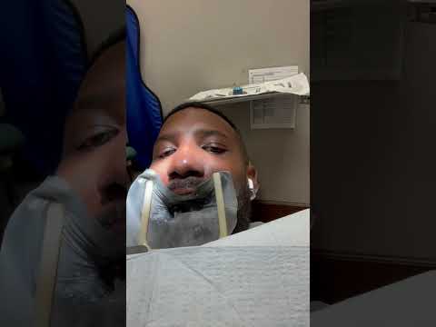 When You Get Dental Implants in Mexico, Gone WRONG!  #reels