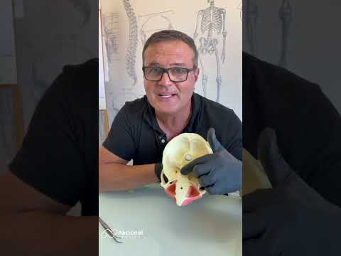 MANEQUIM COM DENTES INCLUSOS E GENGIVA - DENTES 13, 23, 18, 28, 38 E 48 - cód. 11491GT