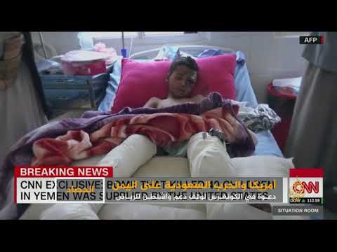 الكونغرس يدعو لوقف دعم الرياض في حرب اليمن