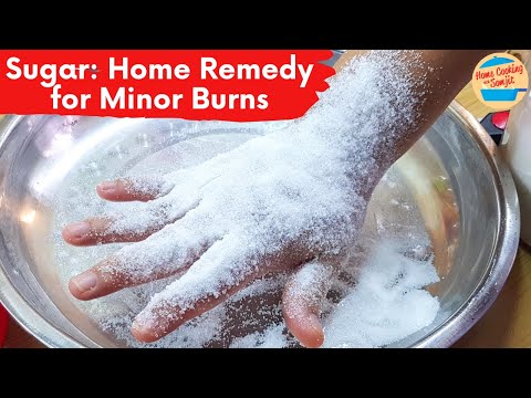 Sugar: A Home Remedy for Minor Burn Relief | My Experience