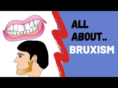 All About Bruxism