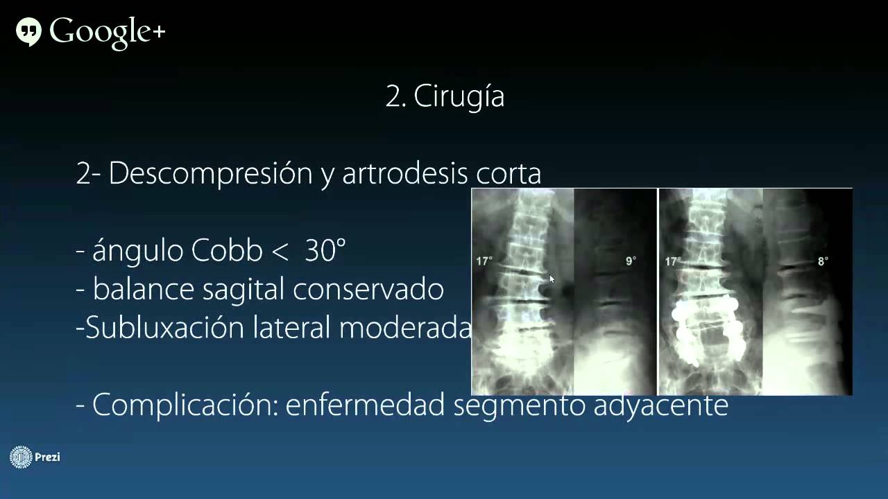 Sergio Alvarado Tellez-5