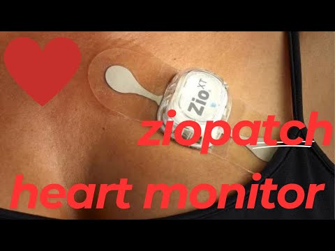Zio Patch Heart Monitor
